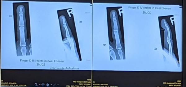 20210617_autsch.jpg