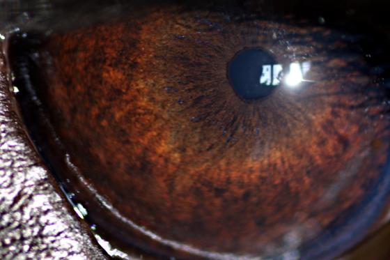 irisdiagnostik.jpg